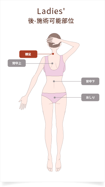 部位別料金：レディース後-施術可能部位