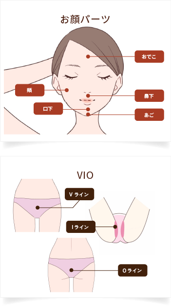 部位別料金：レディースお顔パーツ-VIO 施術可能部位
