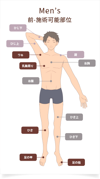 部位別料金：メンズ前-施術可能部位