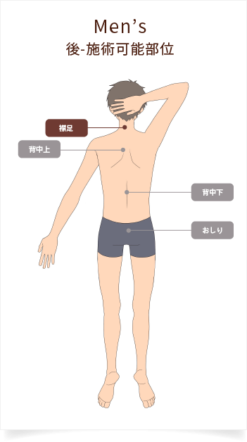 部位別料金：メンズ後-施術可能部位
